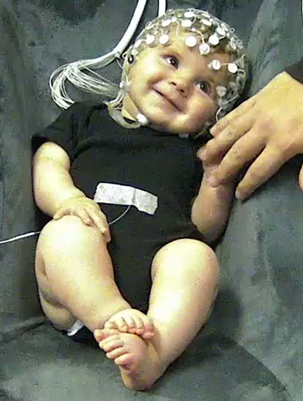 Smiling baby with EEG